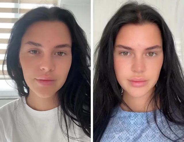 Nelly's appearance before eye surgery